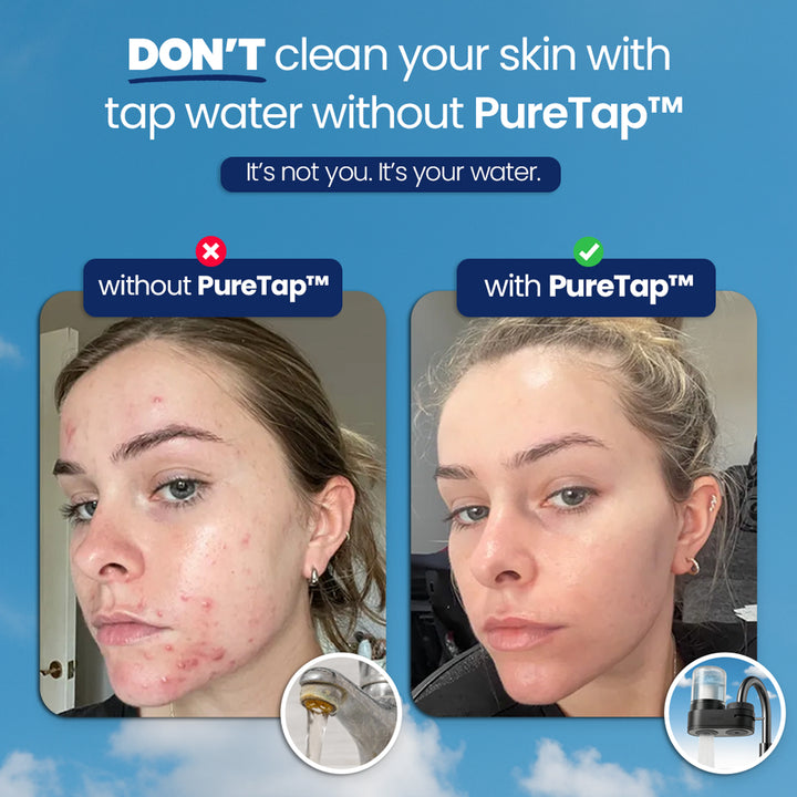 VivaClean PureTap™ – Cleaner Water. Healthier Living.